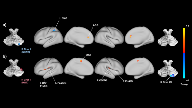6f9d2e7a659b7cdfd4c5bb6efe88dd7d_1642741778_0081.png 6f9d2e7a659b7cdfd4c5bb6efe88dd7d_1642741778_0081.png